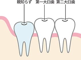 正常な親知らず