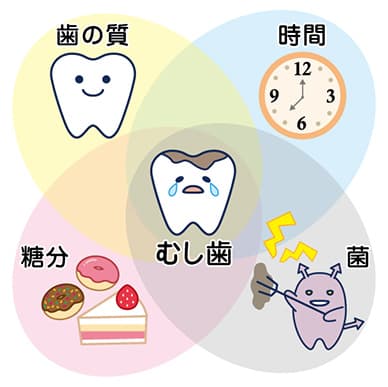 むし歯の原因